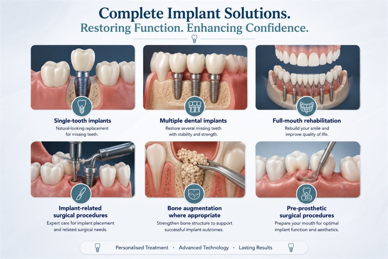 Complete implant solutions