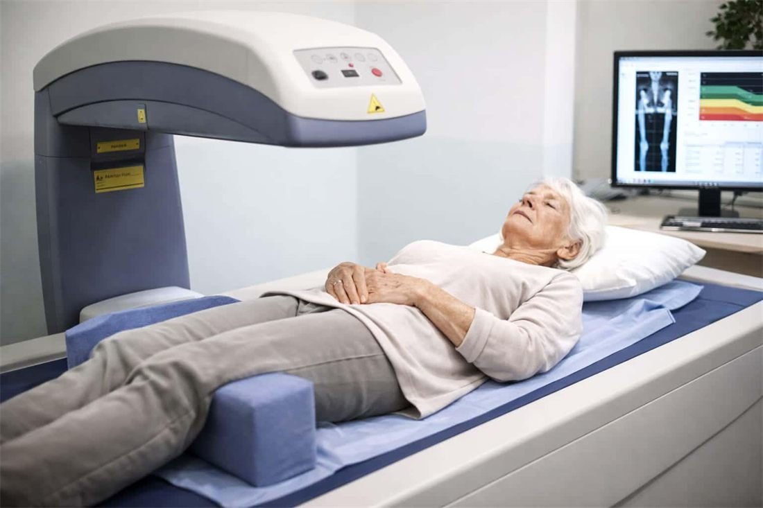 DXA bone density assessment